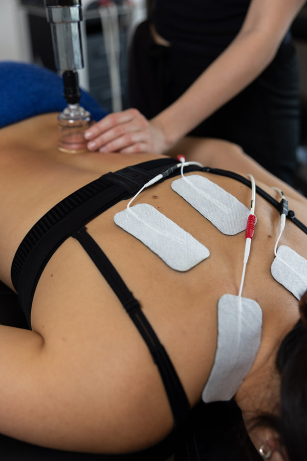 Electric Stimulation